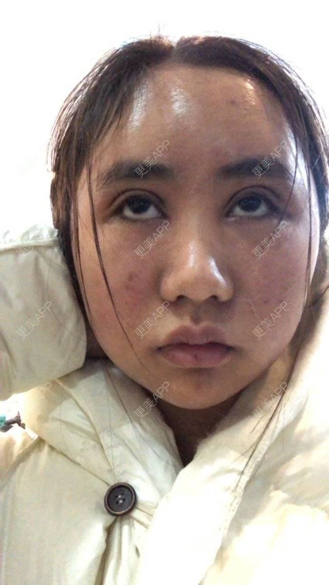 更美 - 苏州工业园区颜术医疗美容诊所的经验 | 芜湖