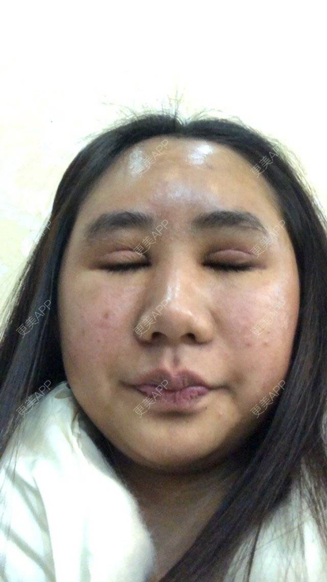 更美 - 苏州工业园区颜术医疗美容诊所的经验 | 芜湖