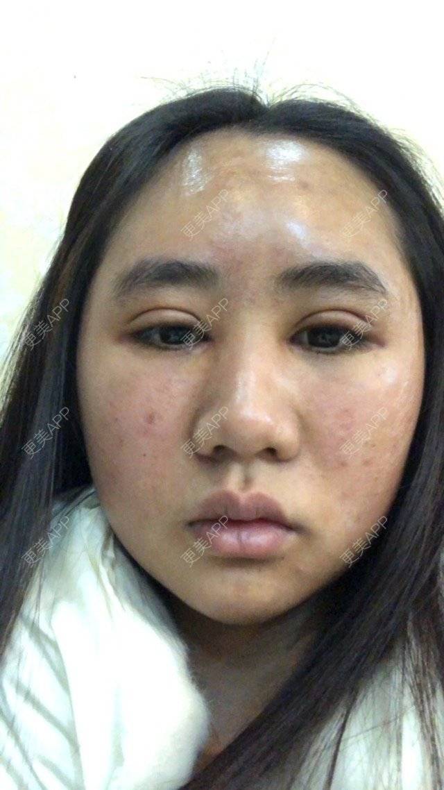 更美 - 苏州工业园区颜术医疗美容诊所的经验 | 芜湖