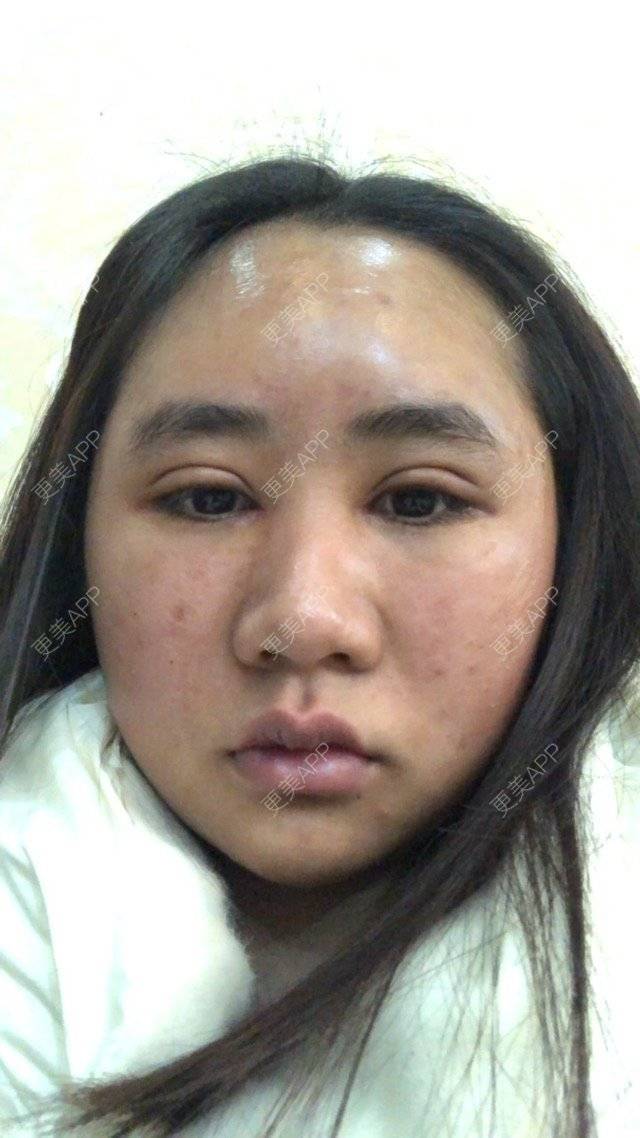 更美 - 苏州工业园区颜术医疗美容诊所的经验 | 芜湖