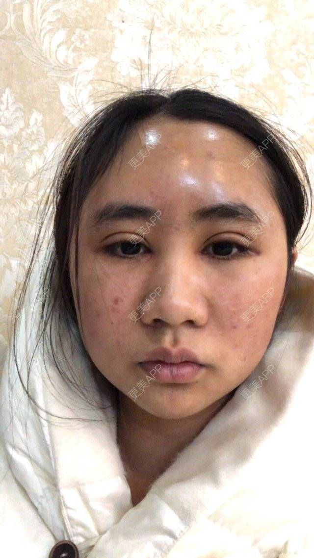 更美 - 苏州工业园区颜术医疗美容诊所的经验 | 芜湖