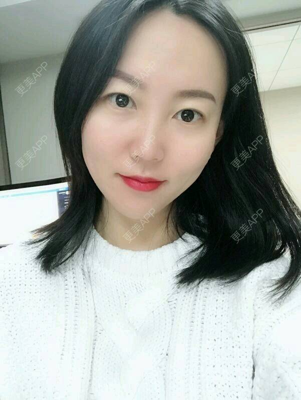 更美 - wlhh的黑脸娃娃经验 | 杭州 | 黑脸娃娃