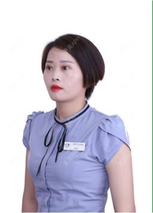 更美 - 段天香 医生的全切双眼皮经验 | 全切双眼皮 | 苏州