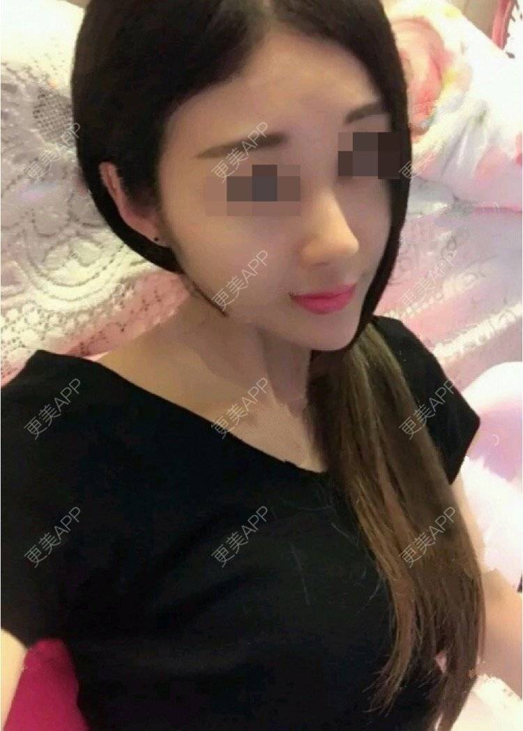 更美 - 重庆艾俪医疗美容(南滨路院)的除皱瘦脸经验 | 重庆 | 除皱瘦脸