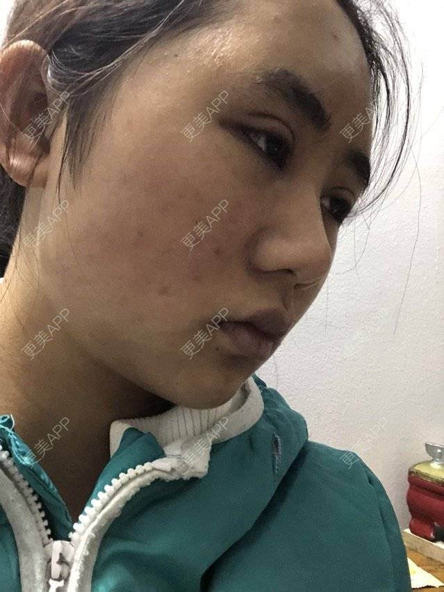 更美 - 苏州工业园区颜术医疗美容诊所的经验 | 芜湖