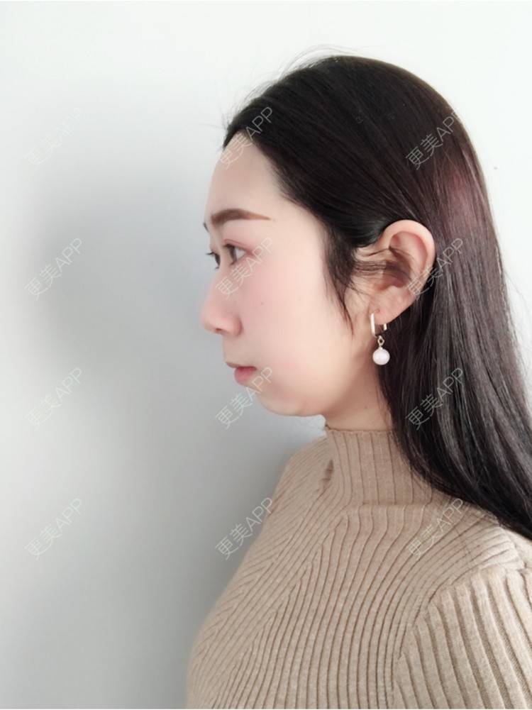 七个隆咚锵的下巴日记