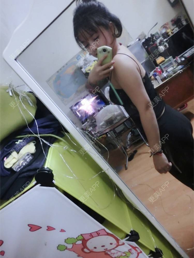 更美 - Joni小小板娘的射频溶脂瘦手臂经验 | 上海 | 视频日记 | 射频溶脂瘦手臂