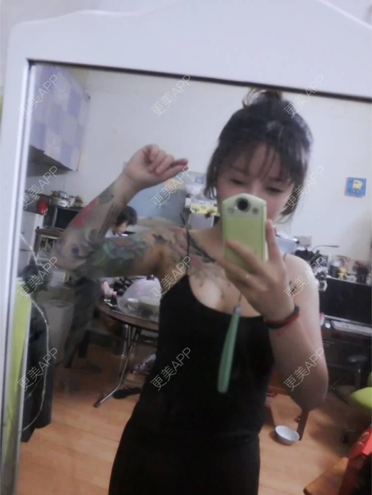 更美 - Joni小小板娘的射频溶脂瘦手臂经验 | 上海 | 视频日记 | 射频溶脂瘦手臂
