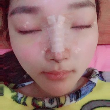 雪儿妹子