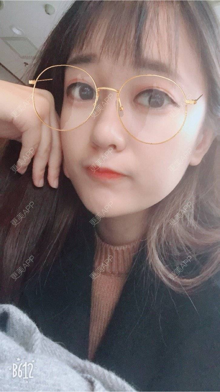 更美 - 匆匆1108的全脸整形套餐经验 | 全脸整形套餐 | 鼻部整形 | 武汉 | 隆鼻