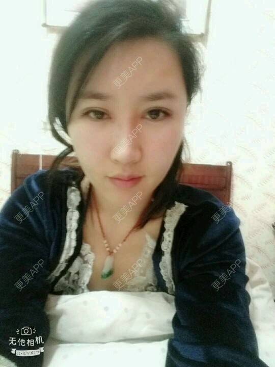 更美 - LOw3的吸脂瘦脸经验 | 吸脂瘦脸 | 南昌