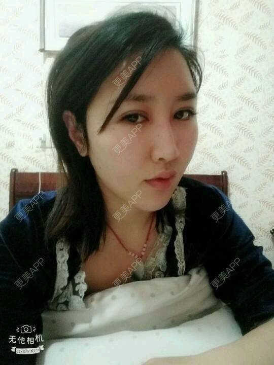 更美 - LOw3的吸脂瘦脸经验 | 吸脂瘦脸 | 南昌