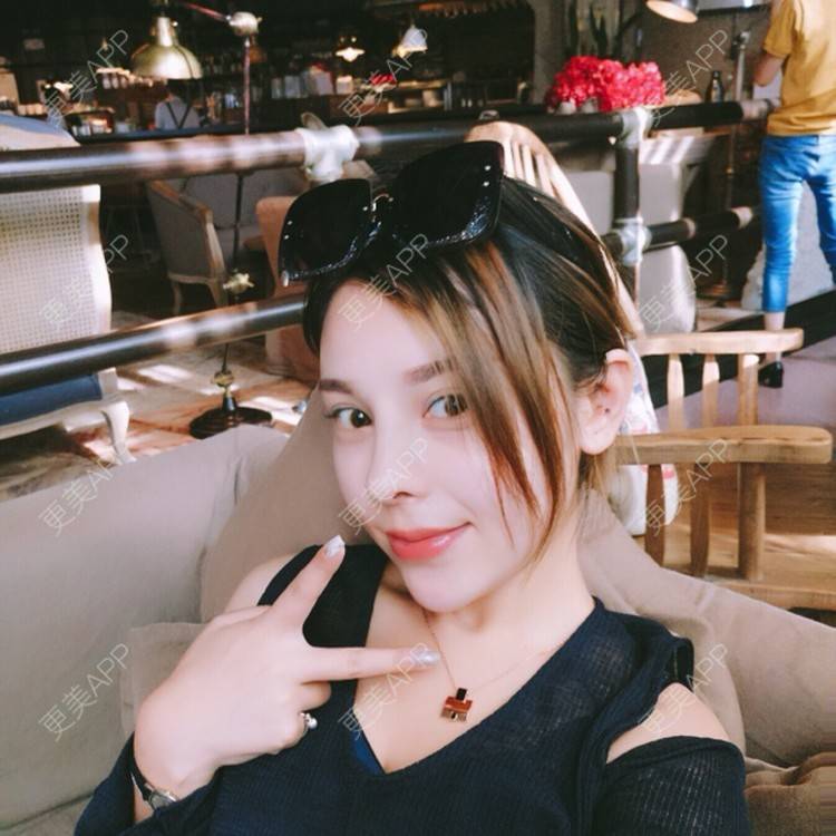 更美 - 薇一美静静💗的耳软骨隆鼻经验 | 假体鼻子下巴 | 鼻中隔软骨垫鼻头 | 合肥 | 耳软骨隆鼻