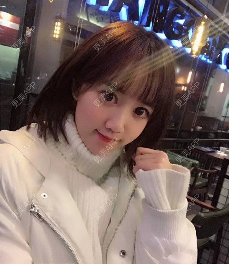 更美 - mikobb的腰腹吸脂经验 | 成都 | 腰腹吸脂