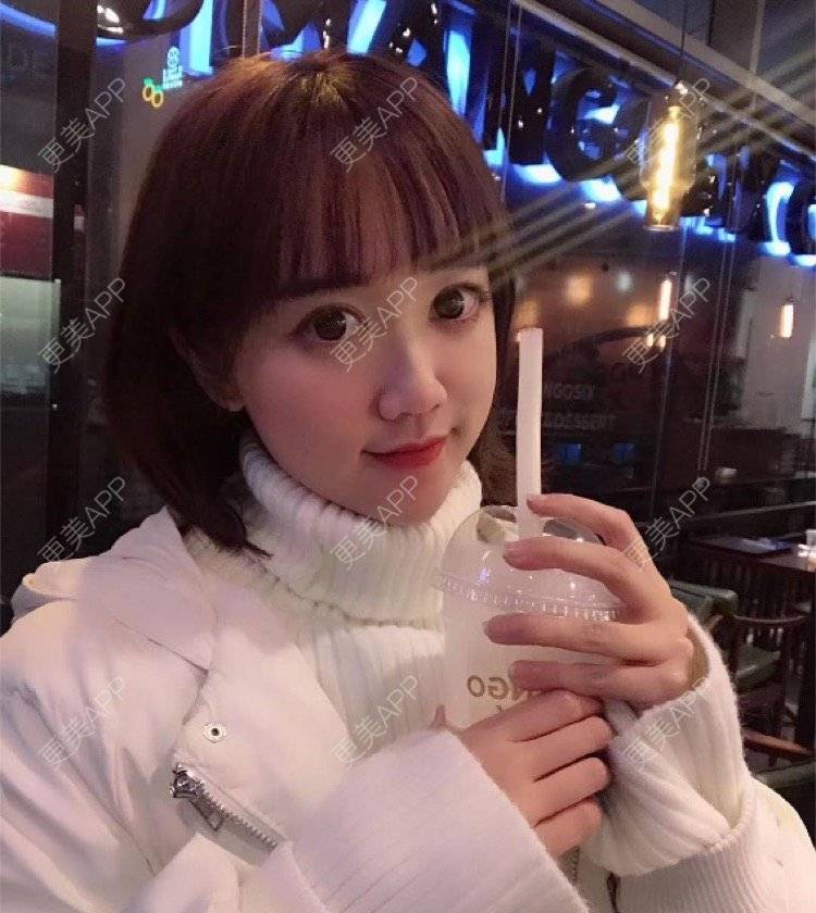 更美 - mikobb的腰腹吸脂经验 | 成都 | 腰腹吸脂