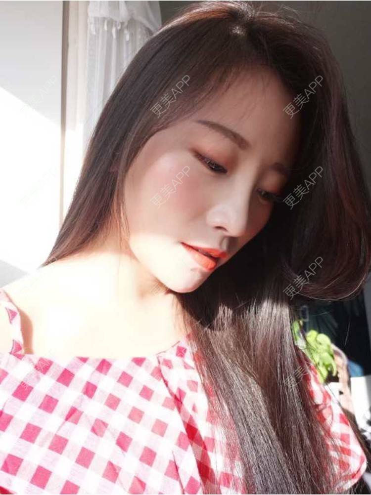 更美 - 南方有佳木的祛眼袋经验 | 北京去眼袋 | 激光去眼袋 | 祛眼袋 | 北京