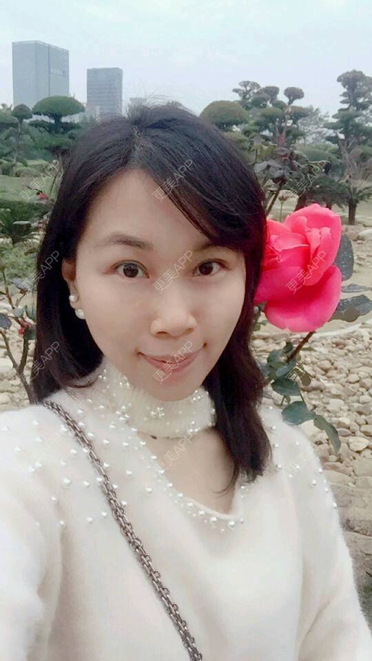 更美 - 变成美大妈的经验 | 自体脂肪面部年轻化 | 吸脂 | 武汉