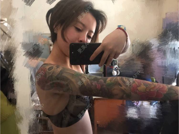 更美 - Joni小小板娘的射频溶脂瘦手臂经验 | 上海 | 视频日记 | 射频溶脂瘦手臂