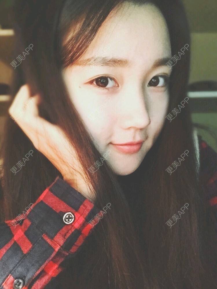 更美 - 凌萱酱的膨体垫下巴经验 | 重庆 | 膨体垫下巴