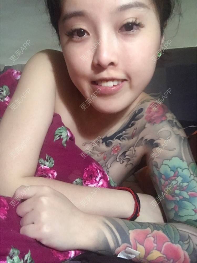 更美 - Joni小小板娘的射频溶脂瘦手臂经验 | 上海 | 射频溶脂瘦手臂 | 视频日记