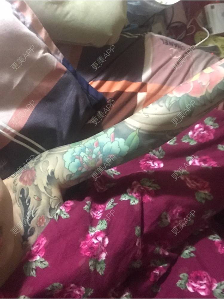 更美 - Joni小小板娘的射频溶脂瘦手臂经验 | 上海 | 射频溶脂瘦手臂 | 视频日记