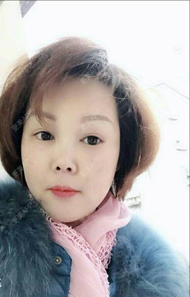 更美 - Eugenec的自体脂肪丰面颊经验 | 面部轮廓 | 自体脂肪面部年轻化 | 武汉 | 自体脂肪丰面颊