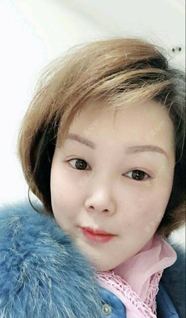 更美 - Eugenec的自体脂肪丰面颊经验 | 面部轮廓 | 自体脂肪面部年轻化 | 武汉 | 自体脂肪丰面颊