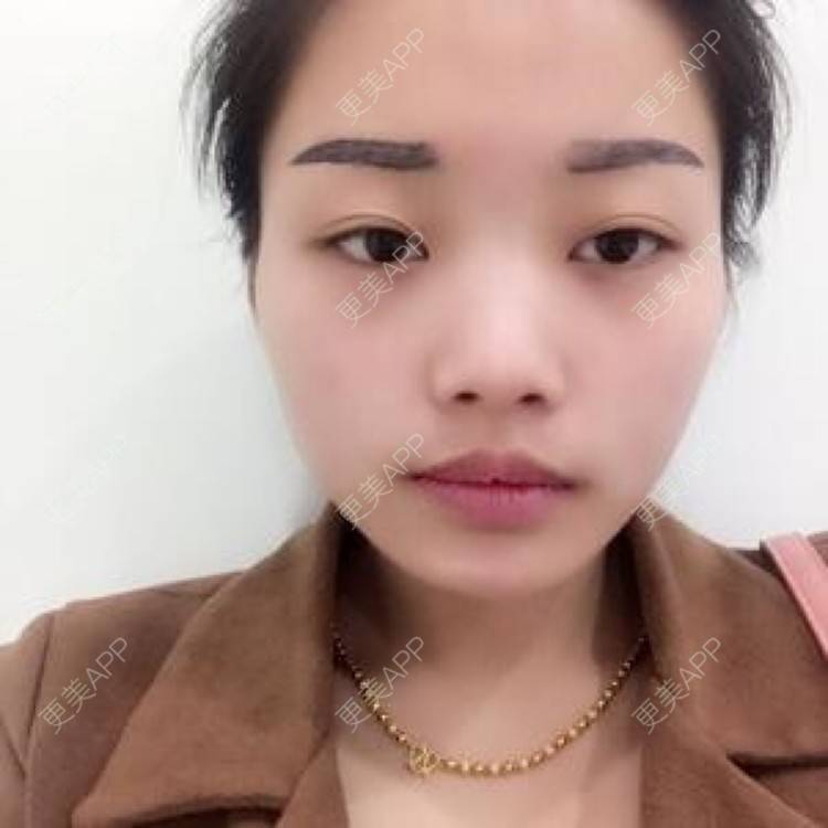 更美 - 体面的分别的半永久妆经验 | 注射美容 | 纹绣 | 半永久妆 | 长沙
