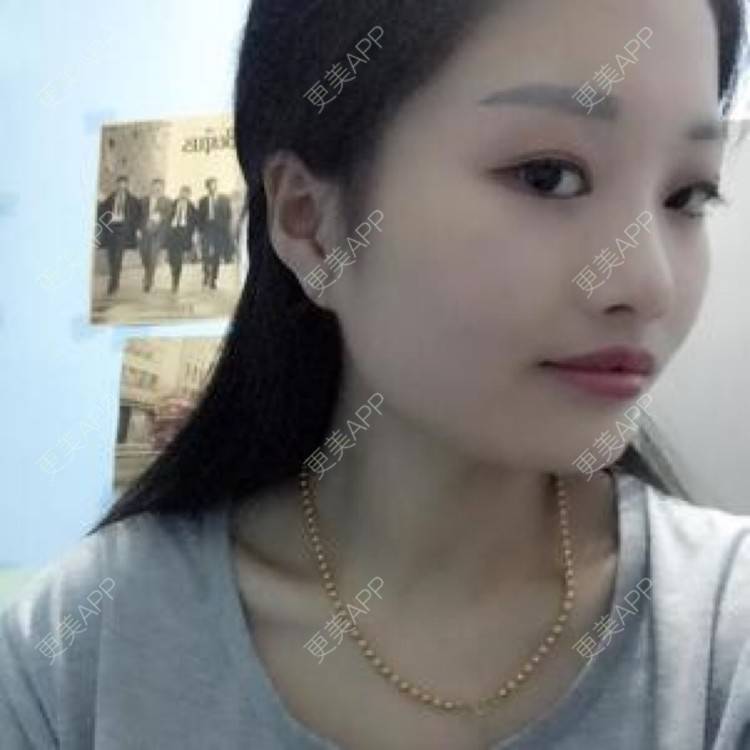 更美 - 体面的分别的半永久妆经验 | 注射美容 | 纹绣 | 半永久妆 | 长沙