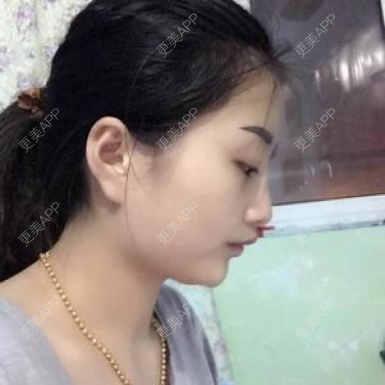 更美 - 体面的分别的半永久妆经验 | 注射美容 | 纹绣 | 半永久妆 | 长沙