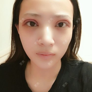 一份流年，倆人受傷