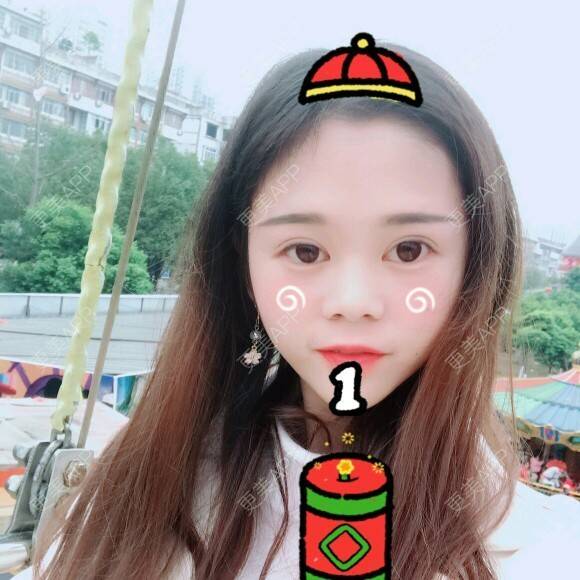 更美 - 潘潘。。的植发际线经验 | 成都 | 视频日记 | 植发际线 | 女性植发 | 鬓角种植
