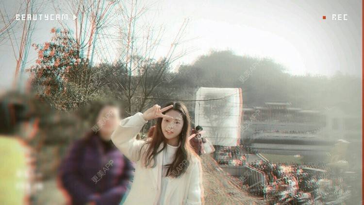 更美 - 潘潘。。的植发际线经验 | 成都 | 视频日记 | 植发际线 | 女性植发 | 鬓角种植