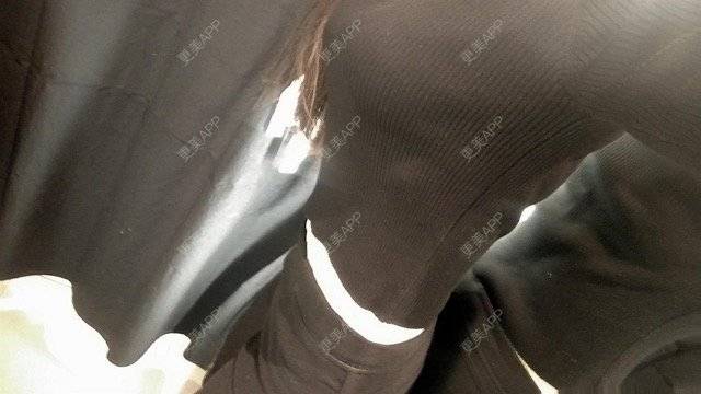 更美 - 许你个假承诺的腰腹吸脂经验 | 侧腰吸脂 | 吸脂手术 | 腰腹吸脂 | 重庆