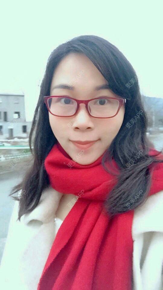 更美 - 变成美大妈的经验 | 自体脂肪面部年轻化 | 武汉