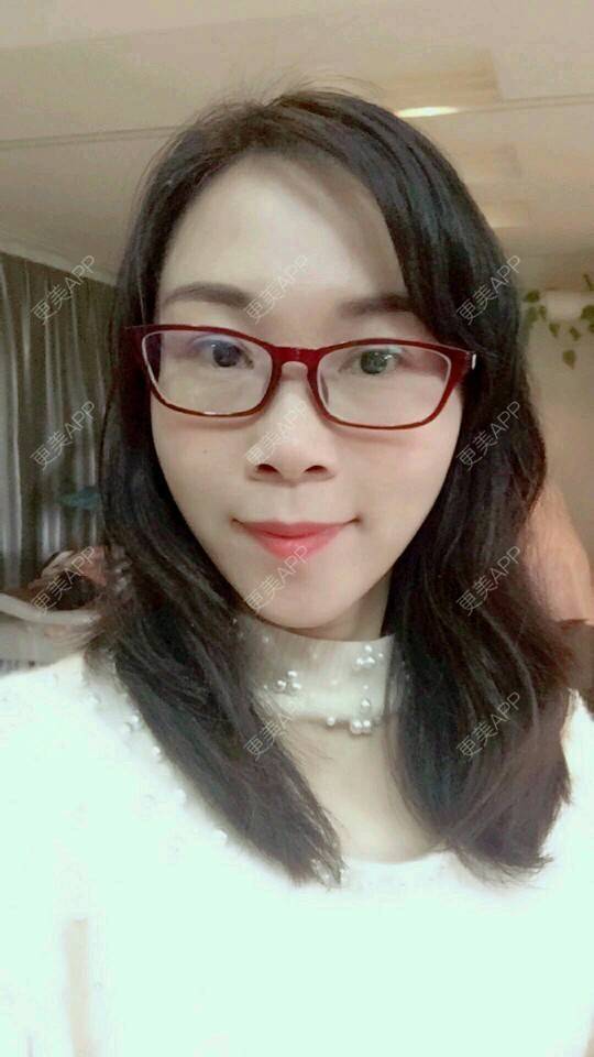 更美 - 变成美大妈的经验 | 自体脂肪面部年轻化 | 武汉