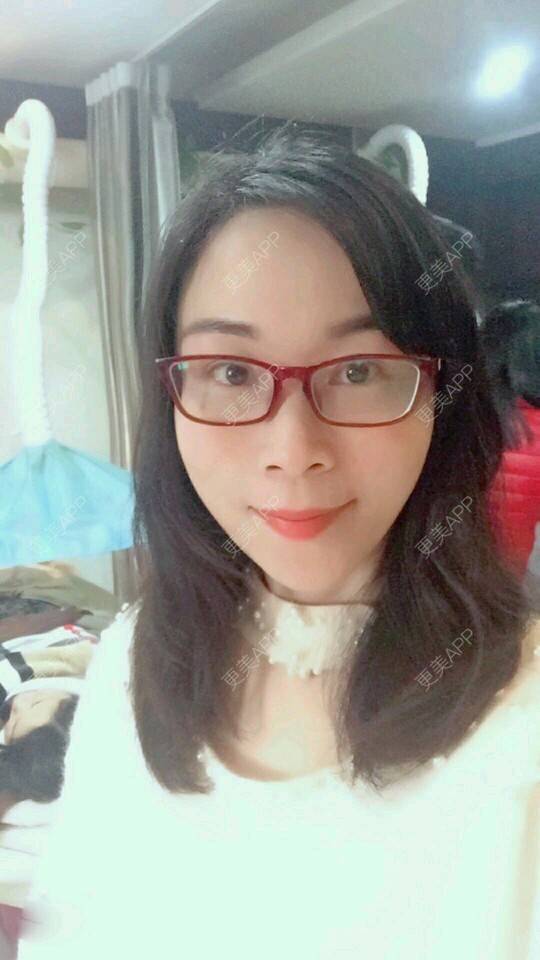 更美 - 变成美大妈的经验 | 自体脂肪面部年轻化 | 武汉