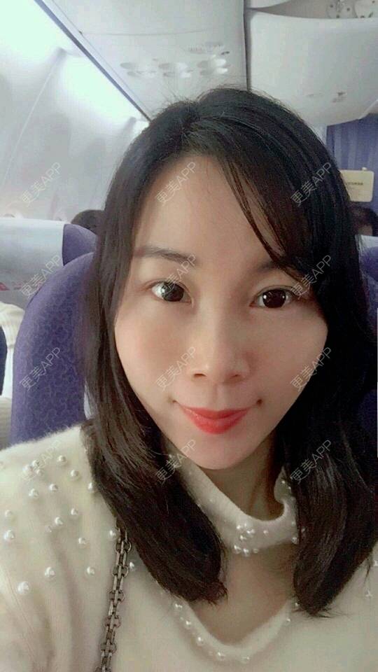 更美 - 变成美大妈的经验 | 自体脂肪面部年轻化 | 武汉