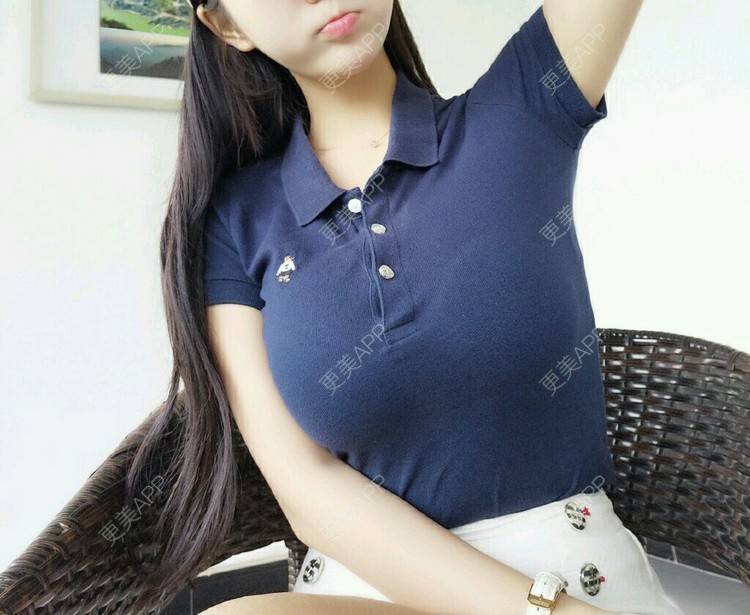 宇宙无敌超级美少女的假体隆胸日记