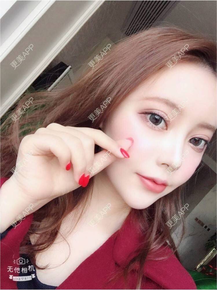 更美 - 苏苏女神的唇综合经验 | 武汉 | 激光脱毛 | 北京 | 杭州 | 唇综合 | 上海 | 自体脂肪隆胸 | 假体隆胸 | 埋线双眼皮 | 广州 | 小气泡 | 吸脂