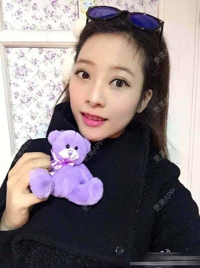 卓琳妹妹的牙齿矫正日记