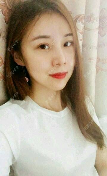 更美 - xNz3B婷的歪鼻矫正经验 | 上海 | 歪鼻矫正