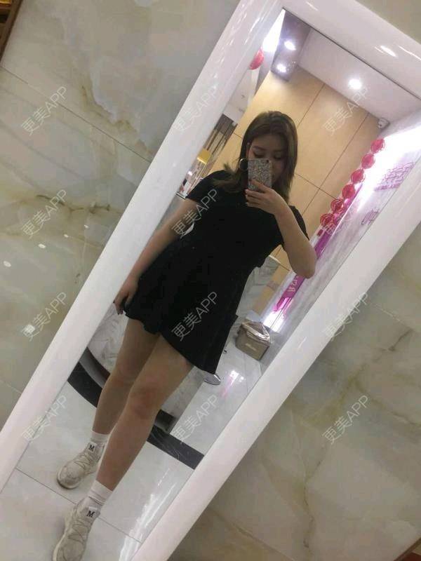 更美 - 更美用户uhjgJzL3xQ的吸脂瘦大腿经验 | 手臂吸脂 | 吸脂 | 吸脂瘦大腿 | 广州