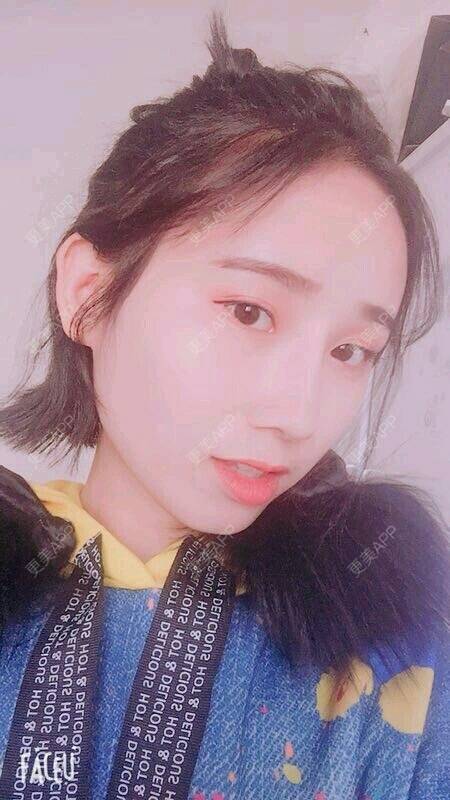 更美 - 萌萌叮当猫的隆鼻经验 | 鼻部膨体假体取出 | 重庆 | 隆鼻 | 鼻形态修复