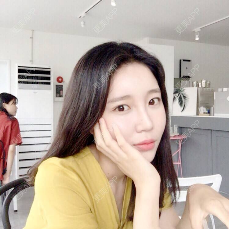更美 - 陈炳伟 医生的玻尿酸唇部经验 | 玻尿酸唇部 | 温州