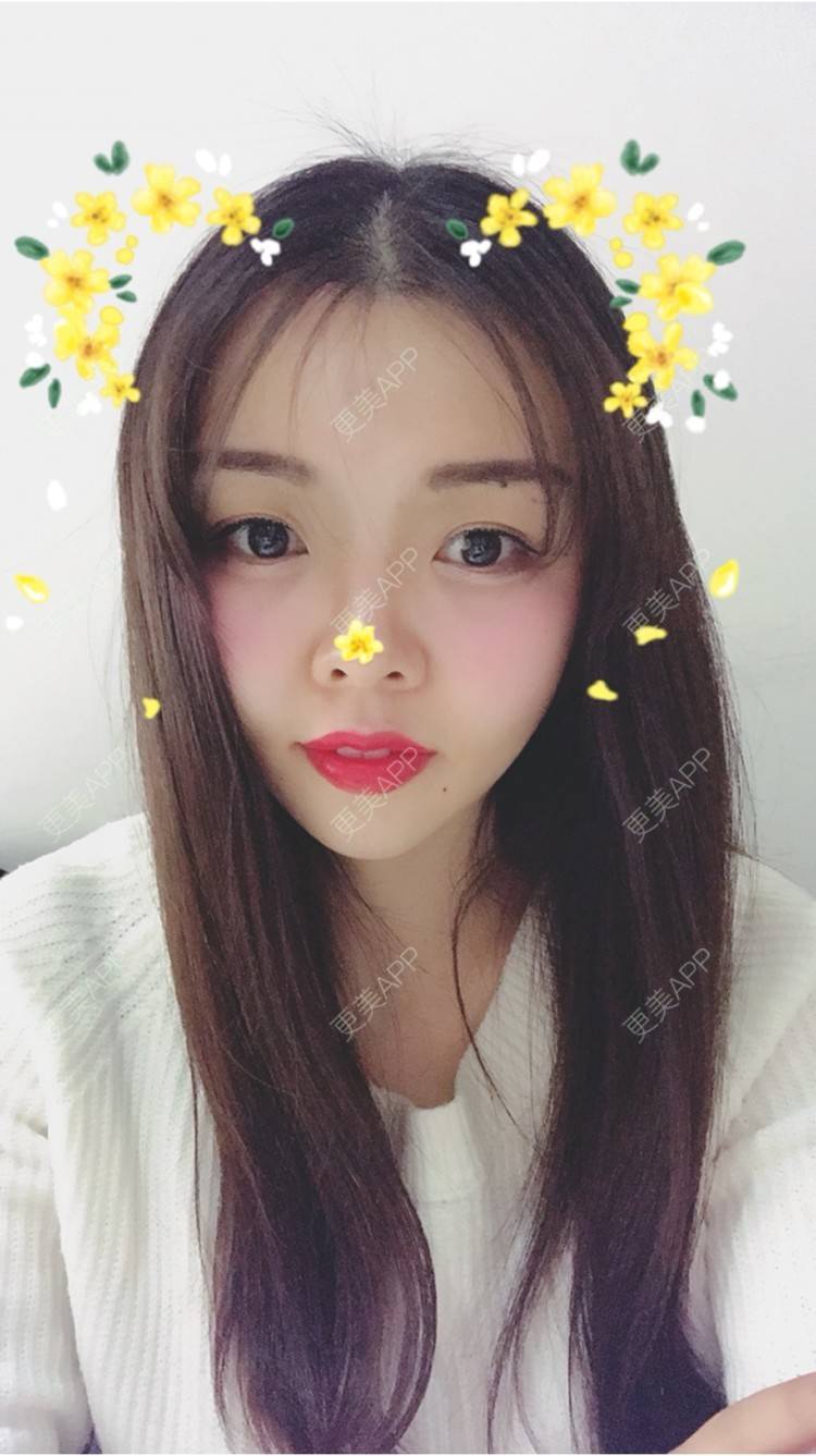 更美 - 顾霏。的植眉经验 | 植眉 | 种植眉毛 | 武汉 | 眉毛种植