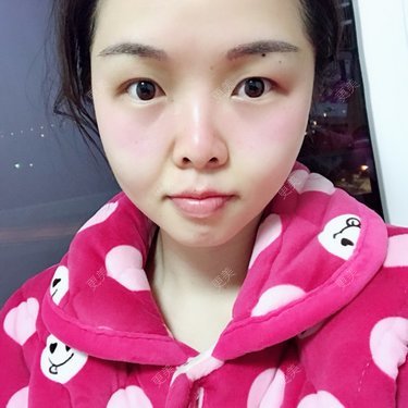 顾霏。