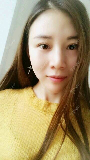 更美 - xNz3B婷的歪鼻矫正经验 | 上海 | 歪鼻矫正