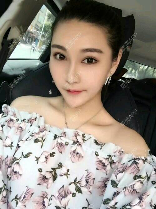 更美 - 吴云 医生的经验 | 杭州