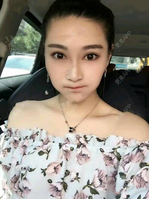 更美 - 吴云 医生的经验 | 杭州